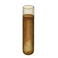 Fructosamine Blood Test