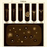 Urine Culture and Sensitivity